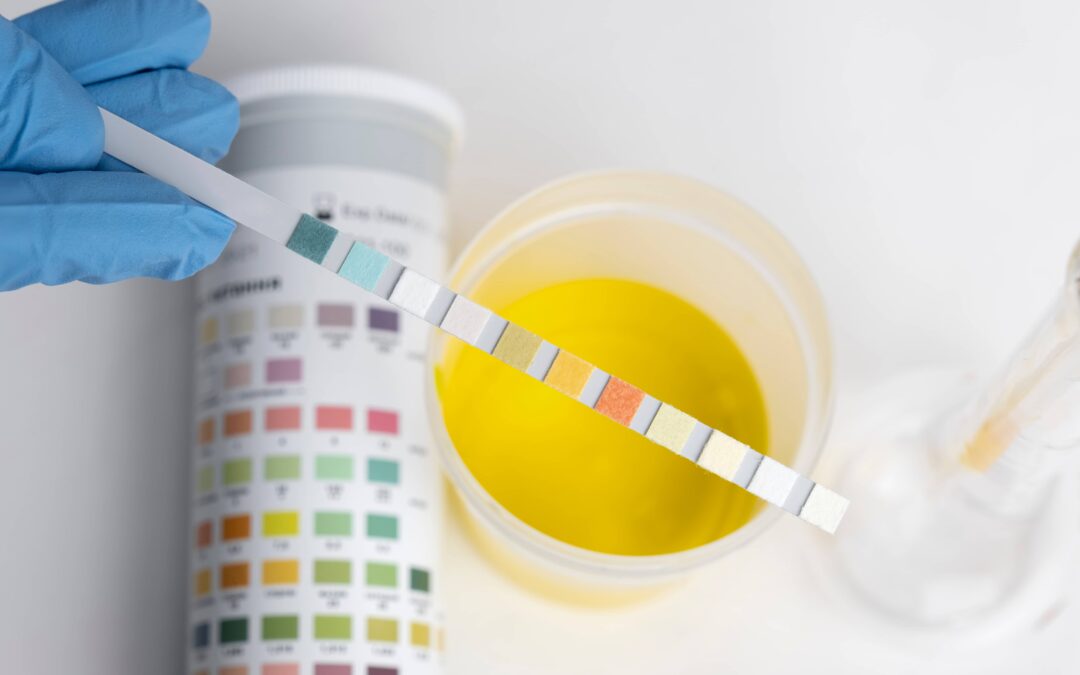ETG Testing Accuracy: Myths and Facts
