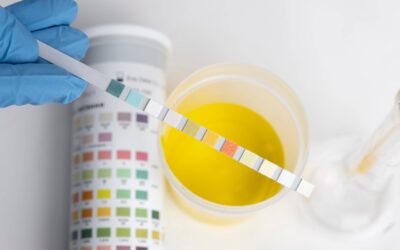 ETG Testing Accuracy: Myths and Facts
