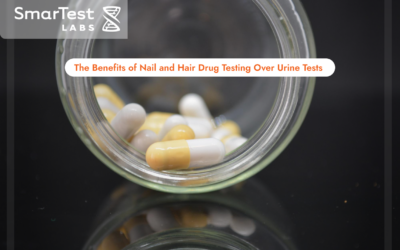The Benefits of Nail and Hair Drug Testing Over Urine Tests